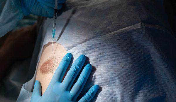 علاج التثدي عند الرجال في السعودية